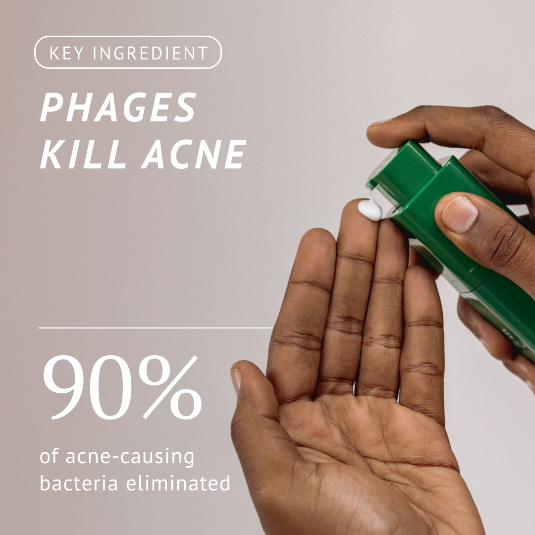 Acne-Fighting Phage Serum (60 Day Supply)